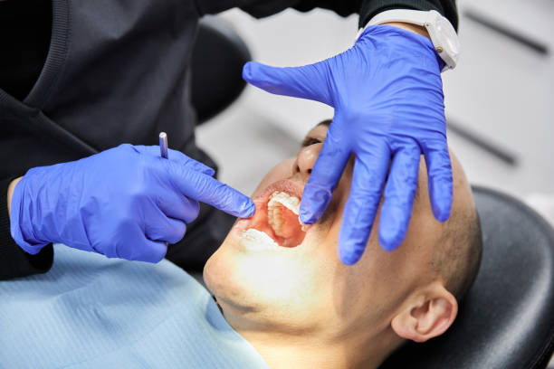 Best Emergency Dental Care for Broken or Chipped Teeth in Hudson, IL